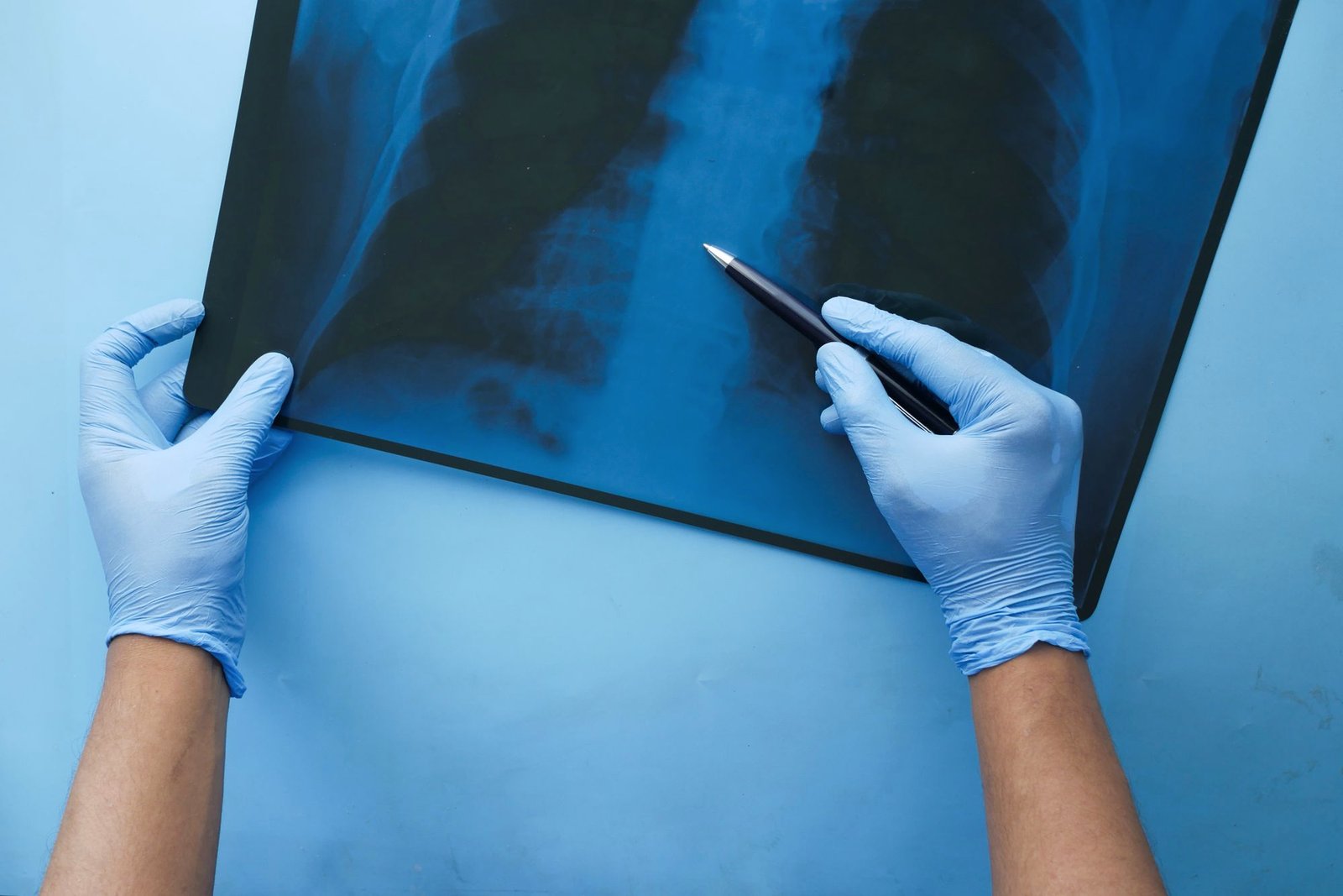 Gloved hands pointing to a chest X-ray